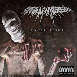 Shrill Whispers : Lacerations